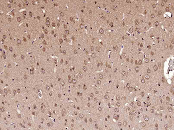 C-fos Rabbit Polyclonal Antibo