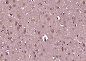 Phospho-Akt (Thr450) Rabbit Po