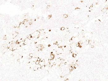 Cytokeratin 19 Recombinant Rab