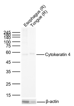Cytokeratin 4 Recombinant Rabb