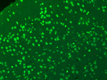 SIP1 Rabbit Polyclonal Antibod