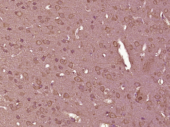 TLR3 Rabbit Polyclonal Antibod