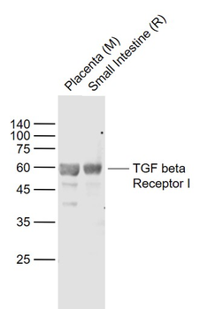TGF beta Receptor I Rabbit Pol