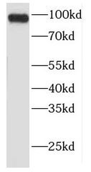 FER Antibody抗体，orb627007，biorb