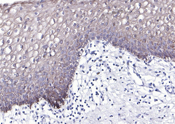 Cytokeratin 4 Recombinant Rabb