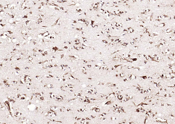 Calreticulin Mouse Monoclonal