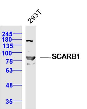 SCARB1/Scavenger Receptor BI R