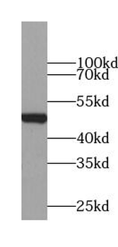 Beta Tubulin Antibody抗体,orb625