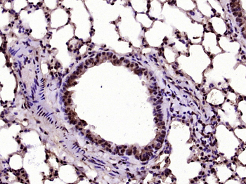 Phospho-AKT1 (Ser129) Rabbit P
