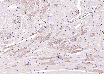 SGPL1 Rabbit Polyclonal Antibo