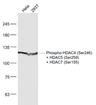 Phospho-HDAC4 (Ser246) + HDAC5