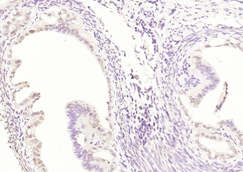 Caspase-12 Rabbit Polyclonal A