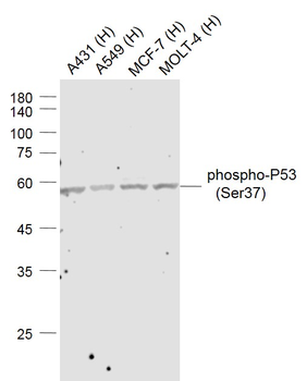 Phospho-P53 (Ser37) Rabbit Pol