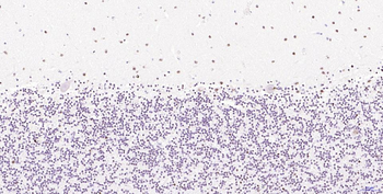 Phospho-H2AX (Ser139) Recombin