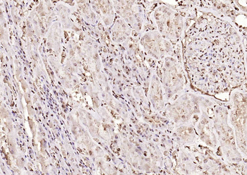 PPM1D Rabbit Polyclonal Antibo