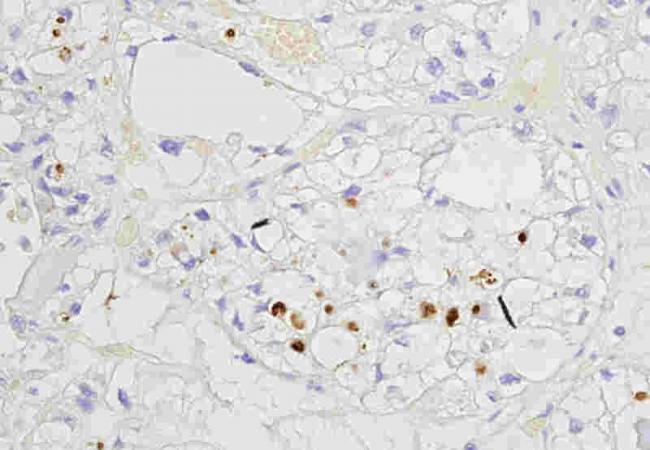 TBX2 Rabbit Polyclonal Antibod