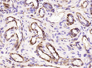 Alpha smooth muscle Actin Reco