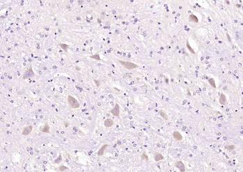 APOD Rabbit Polyclonal Antibod