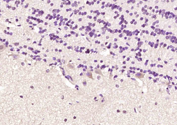 5HT5A receptor Rabbit Polyclon