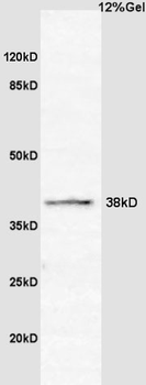 CCNG2 Rabbit Polyclonal Antibo