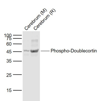 Phospho-Doublecortin (Ser47) R