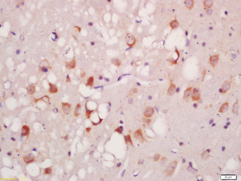 Phospho-ATG1 (Ser556) Rabbit P