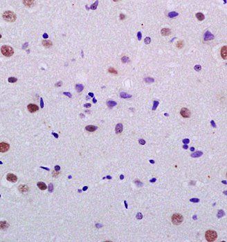 Nuclear Matrix Protein p84 Rab