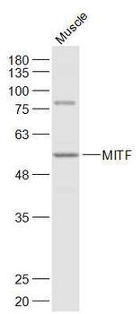 MITF Rabbit Polyclonal Antibod