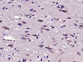 LRP1 Rabbit Polyclonal Antibod