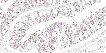 Phospho-H2AX (Ser139) Recombin