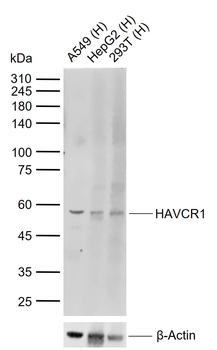 HAVCR1 Rabbit Polyclonal Antib