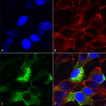 NaVbeta3 Antibody (APC)抗体,orb3
