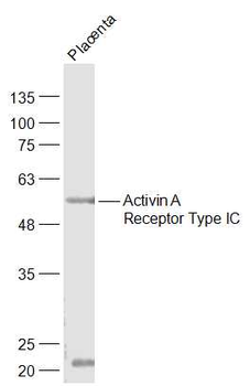 Activin A Receptor Type IC Rab