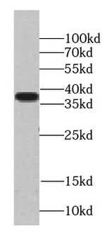 TADA1 Antibody抗体,orb395659,bio