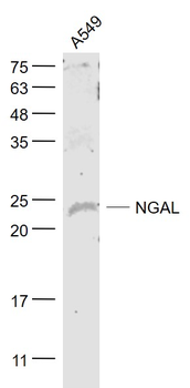 NGAL/Lipocalin 2 Rabbit Polycl
