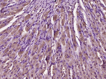 TFF2 Rabbit Polyclonal Antibod