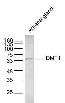 DMT1 Rabbit Polyclonal Antibod