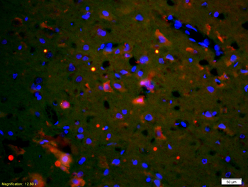 XIAP/BIRC4 Rabbit Polyclonal A