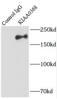 ECPAS Antibody抗体，orb395231，bio