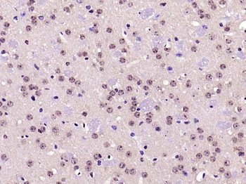 Phospho-PRKCB (Thr642) Rabbit 