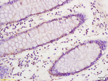 SREBP1 Rabbit Polyclonal Antib