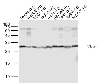 VEGF Rabbit Polyclonal Antibod