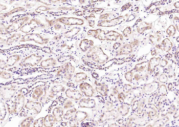 Cathepsin H Rabbit Polyclonal