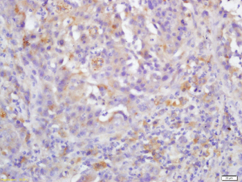 RAF1 Rabbit Polyclonal Antibod
