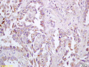 Muscarinic Acetylcholine recep
