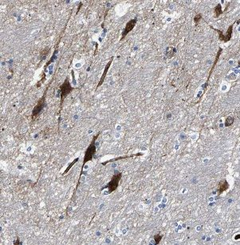 FSD1L Antibody抗体，orb627138，bio