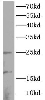 LMO2 Antibody抗体,orb633089,bior