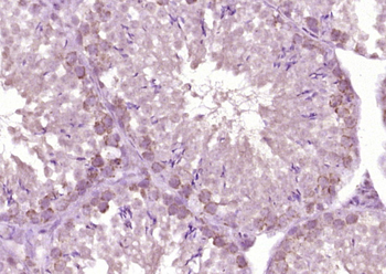 HSD17B3 Rabbit Polyclonal Anti