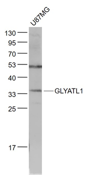 GLYATL1 Rabbit Polyclonal Anti