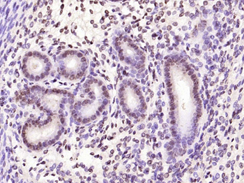 Phospho-CDKN1A/p21 (Thr57) Rab
